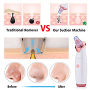 Blackhead Instrument Electric Suction Facial Washing Instrument Beauty Acne Cleaning Blackhead Suction Instrument - TRADINGSUSAWhite SetBlackhead Instrument Electric Suction Facial Washing Instrument Beauty Acne Cleaning Blackhead Suction InstrumentTRADINGSUSA