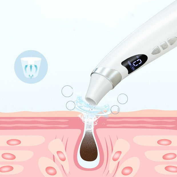 Electric Visual Blackhead Suction Instrument Household Cleansing Pore Cleaner For Skin Equipment Skin Care Tool - TRADINGSUSAWhiteUSBElectric Visual Blackhead Suction Instrument Household Cleansing Pore Cleaner For Skin Equipment Skin Care ToolTRADINGSUSA