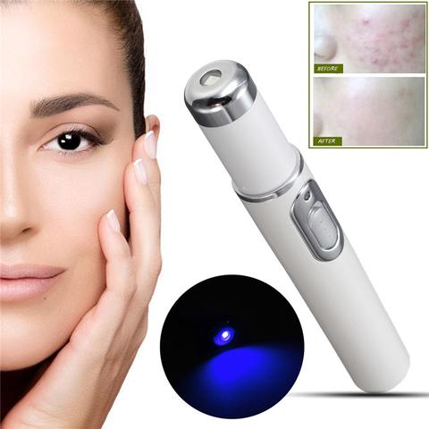 Blue Light Therapy Acne Laser Pen Soft Scar Wrinkle Removal Treatment Device Skin Care Beauty Equipment - TRADINGSUSAHave a logo 2pcsBlue Light Therapy Acne Laser Pen Soft Scar Wrinkle Removal Treatment Device Skin Care Beauty EquipmentTRADINGSUSA